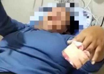 Karyawati di Karawang Meninggal Usai Operasi Jari, Keluarga Pertanyakan Prosedur Medis