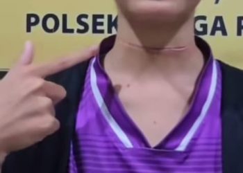 Viral,  Korban Terluka Akibat Benang Layangan, Warganet Desak Pemerintah Kabupaten Melawi Ambil Tindakan Tegas