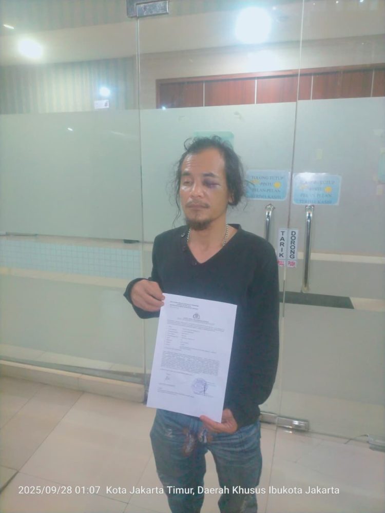 AWIBB Kecam Keras!! Desak Polisi Tangkap Pelaku Pengeroyokan Wartawan di Mangun Jaya Tambun